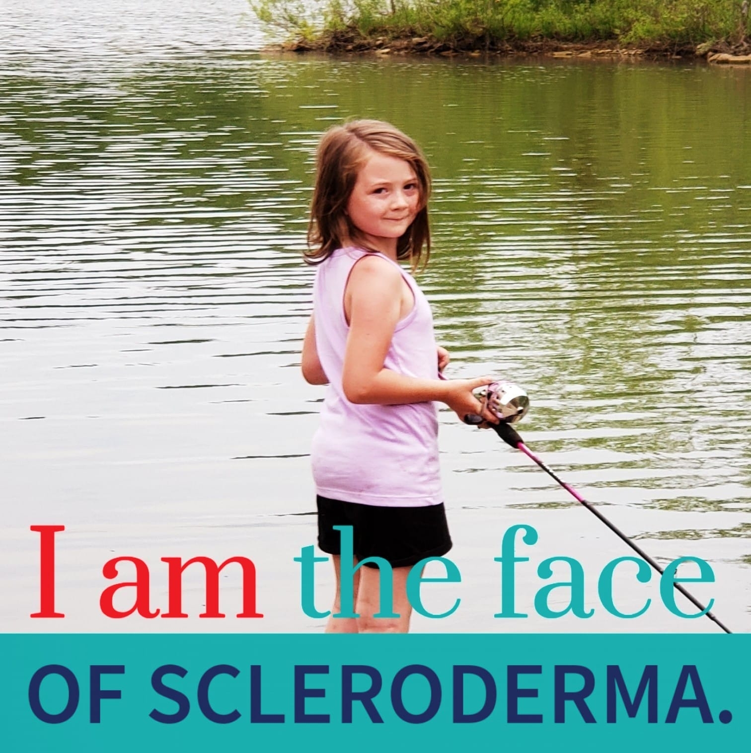 Marlea Depriest – Overcoming Scleroderma